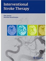 Interventional Stroke Therapy