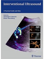 Interventional Ultrasound A Practical Guide and Atlas