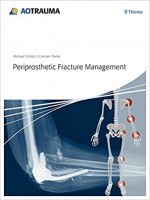 Periprosthetic Fracture Management