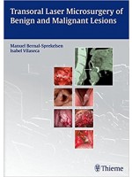 Transoral Laser Microsurgery of Benign and Malignant Lesions