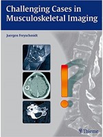 Challenging Cases in Musculoskeletal Imaging