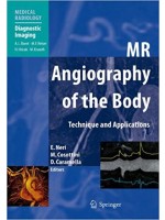 MR Angiography of the Body: Technique & Clinical Application