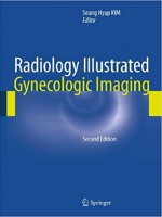Radiology Illustrated: Gynecologic Imaging , 2/e