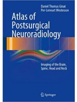 Atlas of Postsurgical Neuroradiology: Imaging of the Brain, Spine, Head & Neck