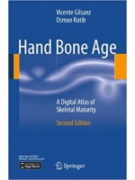 Hand Bone Age: A Digital Atlas of Skeletal Maturity [Paperback]