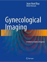 Gynecological Imaging: A Reference Guide to Diagnosis