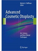 Advanced Cosmetic Otoplasty: Art, Science and New Clinical Techniques