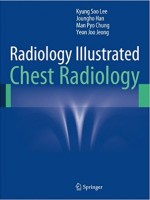 Radiology Illustrated:Chest Radiology