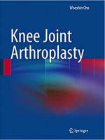 Knee Joint Arthroplasty