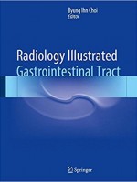 Radiology Illustrated: Gastrointestinal Tract