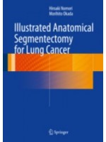 Illustrated Anatomical Segmentectomy for Lung Cancer