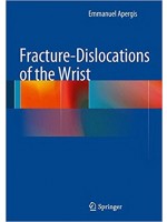 Fracture-Dislocations of the Wrist