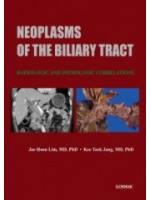 Neoplasms of the Biliary Tract: Radiologic and Pathologic Correlations