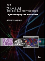 제2판 갑상선-영상진단과 중재시술