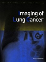 Imaging of Lung Cancer