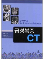 급성복증CT (CT of Acute Abdomen)