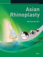 Asian Rhinoplasty