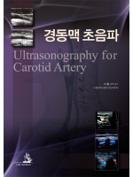 경동맥 초음파 Ultrasonography for Carotid Artery