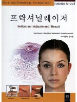 프락셔널레이저(Laser Dermatology-Fractional laser)