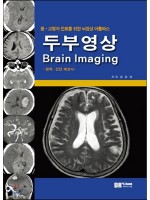 두부영상 Brain Imaging: 중·고령자 진료를 위한 뇌영상 아틀라스