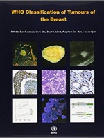 WHO Classification of Tumours of the Breast,4/e