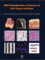 WHO Classification of Tumours of Soft Tissue and Bone