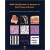 WHO Classification of Tumours of Soft Tissue and Bone