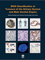 WHO Classification of Tumours of the Urinary System and Male Genital Organs