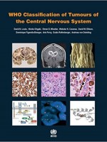 WHO Classification of Tumours of the Central Nervous System,4/e(Revised Edition)