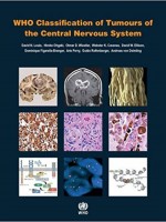 WHO Classification of Tumours of the Central Nervous System,4/e(Revised Edition)